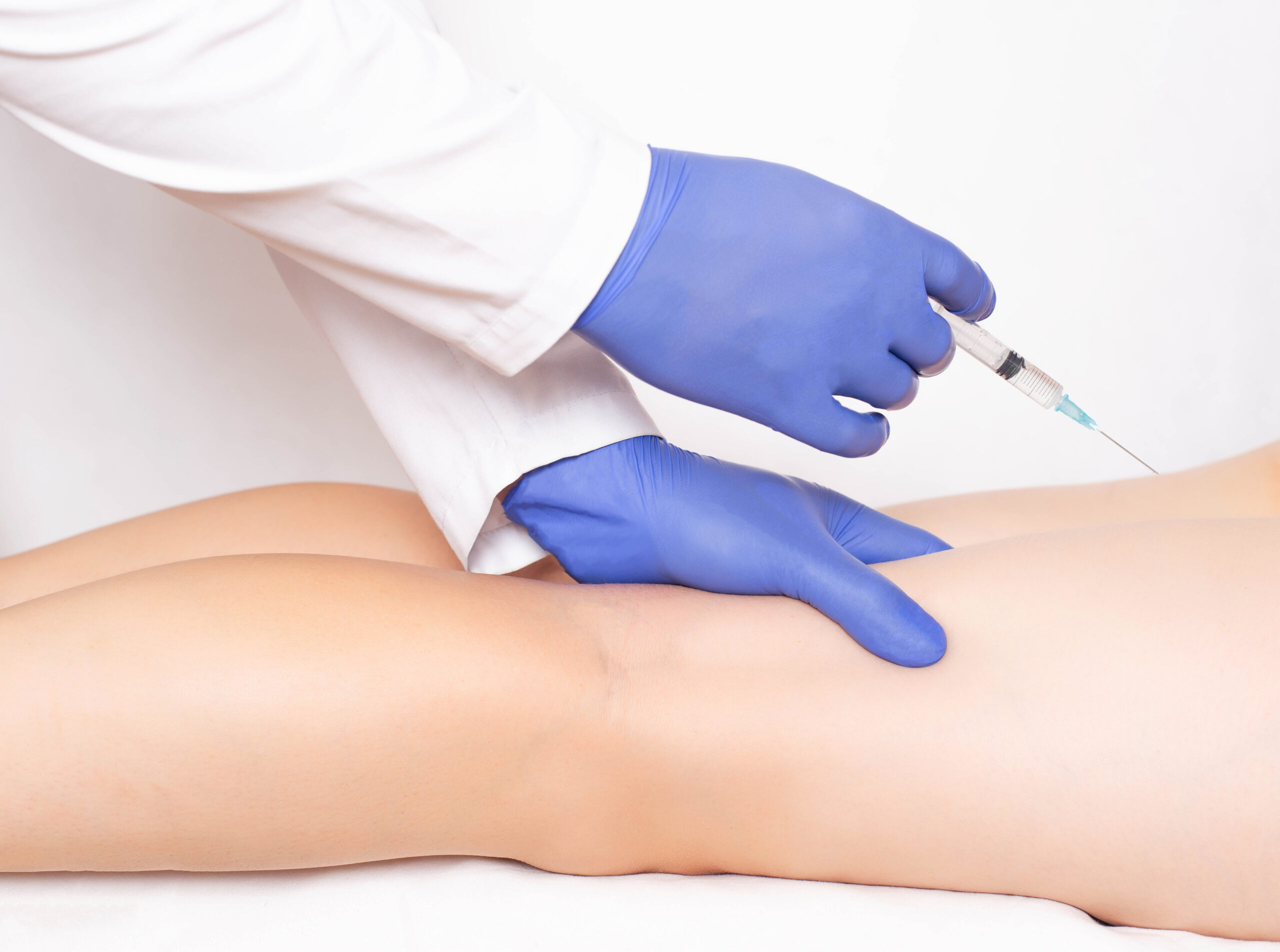Sclerotherapy by RefineKC Aesthetics in NW Vivion Suite 107 Kansas City MO