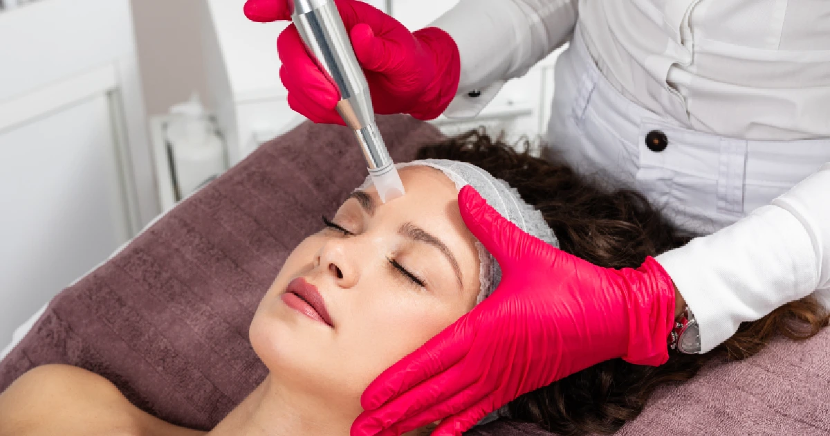 Women Receiving Medical Microneedling in Kansas City, MO