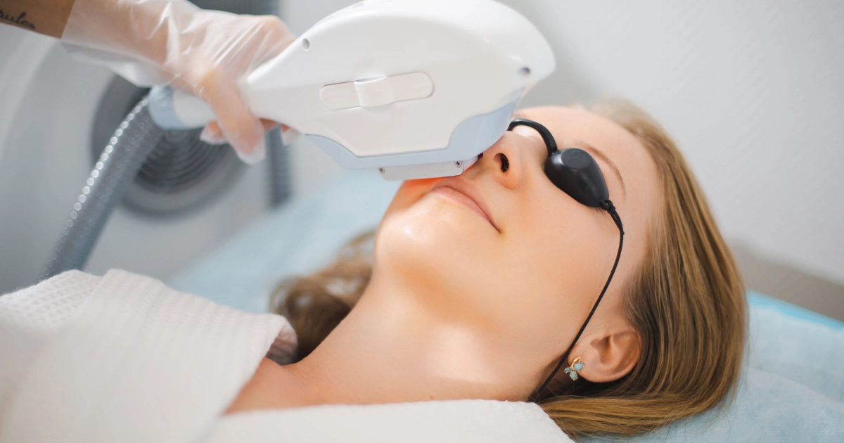 Close-up of a woman wearing eye shields receiving an Upper Lip Laser Hair Removal treatment in Kansas City, MO.