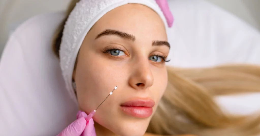 Close-up of a young blonde woman with a white headband as a professional prepares to insert a PDO thread into her cheek in Kansas City, MO.