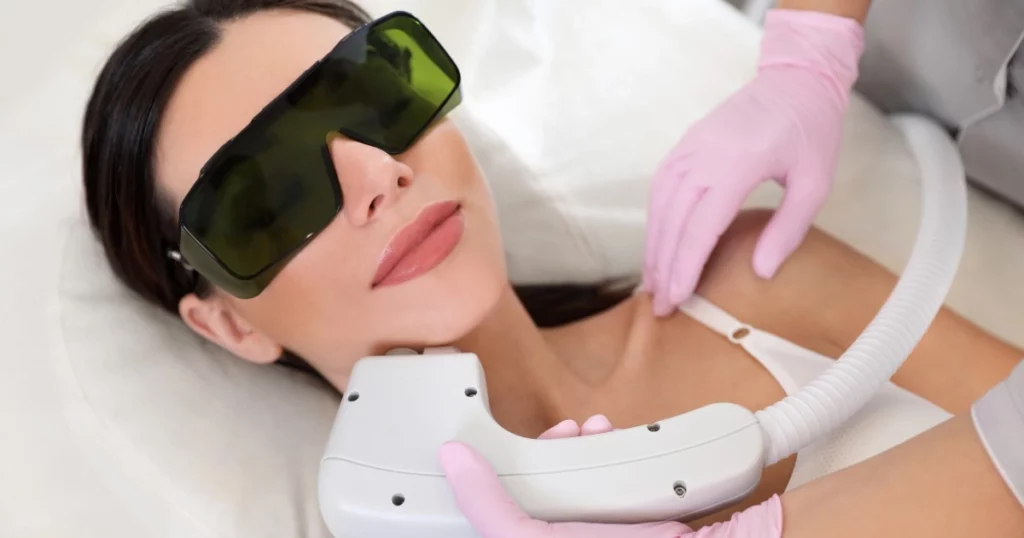 Laser Hair Removal for Chin in Kansas City, MO
