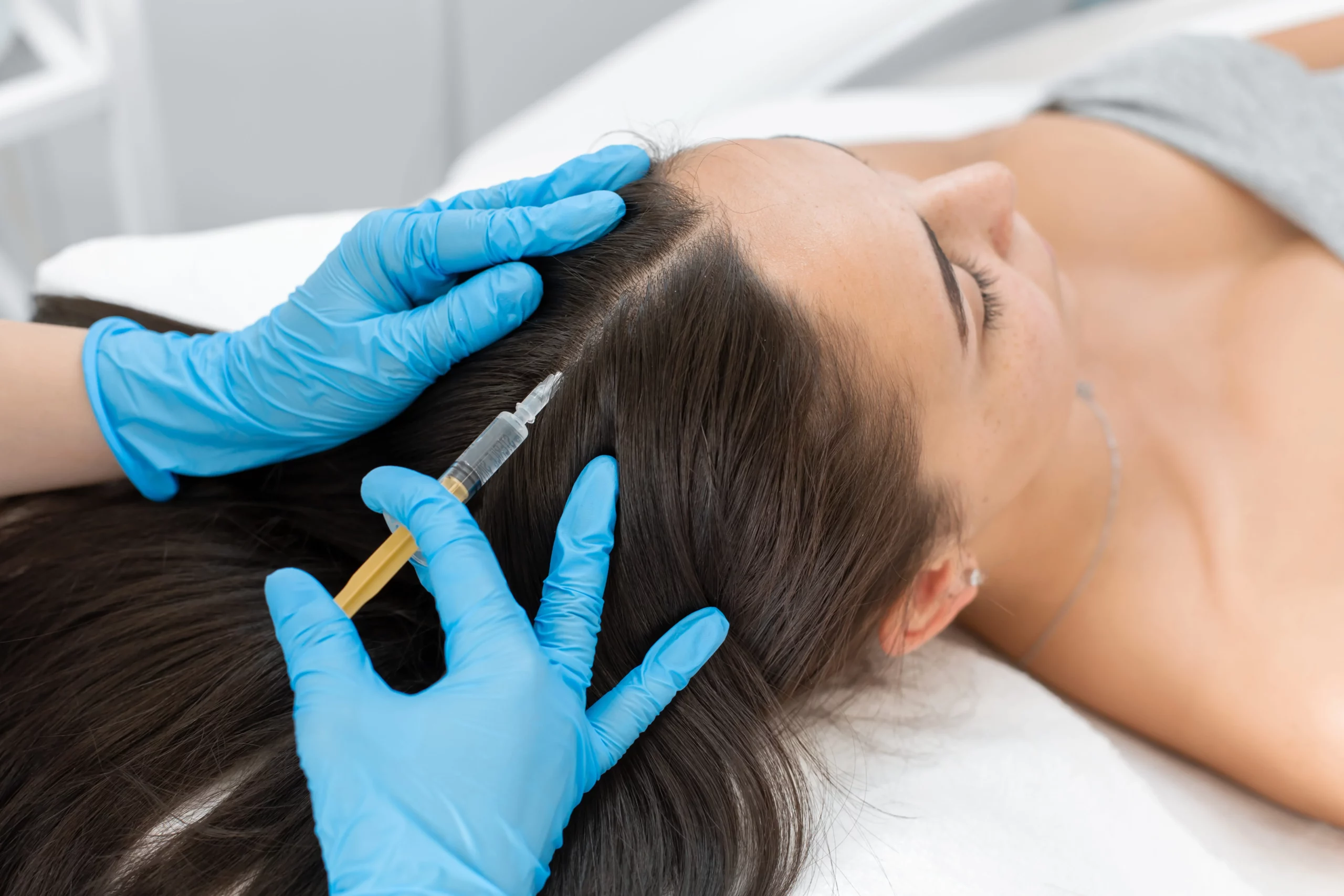 Client Receiving PRP Hair Restoration Treatment in Kansas City, MO